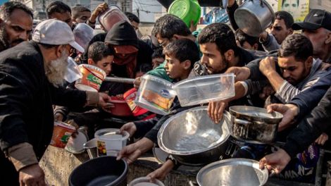 La combinación letal de hambre y enfermedades provocará más muertes en Gaza