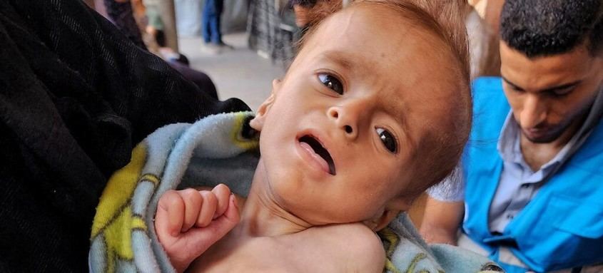Crisis humanitaria en Gaza: muertes diarias por hambre y desnutrición